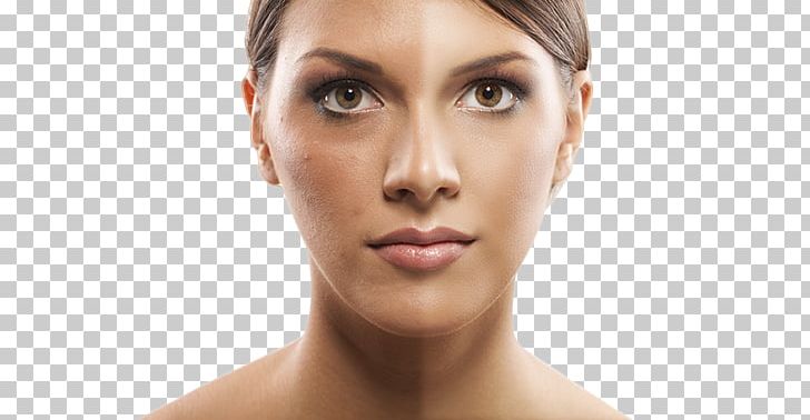 Photography Skin Cosmetics Face PNG, Clipart, Aloe Vera Pulp 12 0 1, Beauty, Brown Hair, Cheek, Chin Free PNG Download