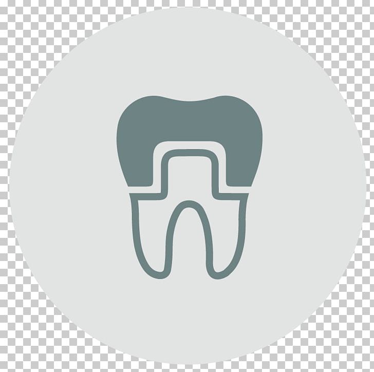 Tooth River Birch Dental CAD/CAM Dentistry Crown PNG, Clipart, Brand, Cadcam Dentistry, Computeraided Design, Crown, Crown Prosecution Service Free PNG Download