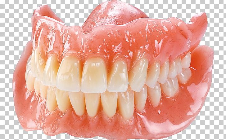 Tooth Dentures Dentistry あさがお歯科高座渋谷 PNG, Clipart, Clinic, Cosmetic Dentistry, Dental Laboratory, Dental Technician, Dentist Free PNG Download