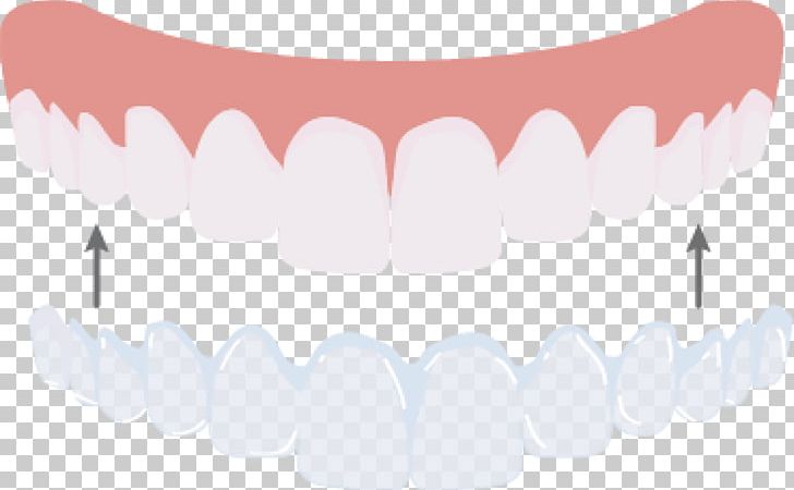 Tooth Jaw Mouth Pink M PNG, Clipart, Art, Beaumont, Beautym, Dentist, Dentistry Free PNG Download