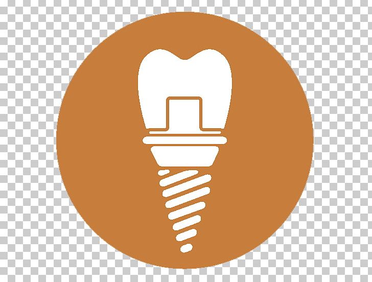 Dentistry Dental Implant My Dentist In Plano: Darren Dickson PNG, Clipart, Acid Erosion, Circle, Corrosion, Dental Implant, Dentist Free PNG Download