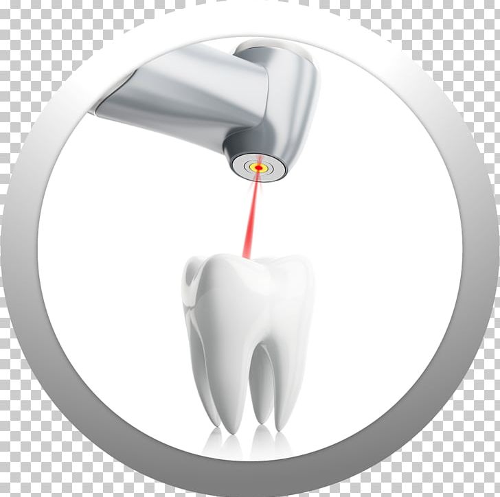 Dental Laser Dentistry Tooth PNG, Clipart, Dental, Dental Laser, Dentist, Dentistry, Endodontics Free PNG Download