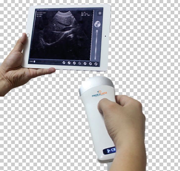 Mobile Phones Ultrasonography Ultrasound Medicine Doppler Echocardiography PNG, Clipart, Agama, Cause, Disease, Electronic Device, Electronics Free PNG Download