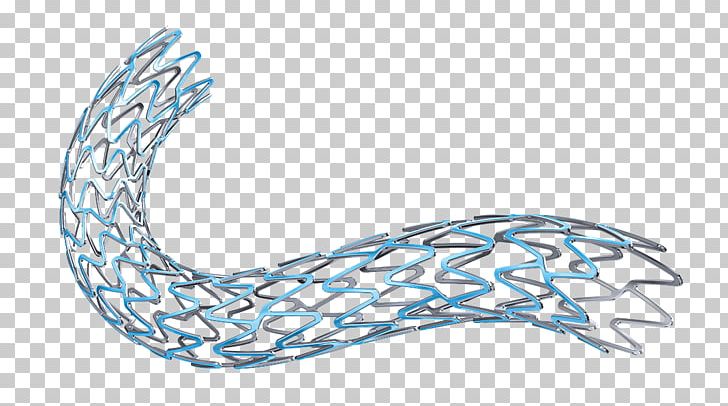 Stenting Drug-eluting Stent Coronary Stent Bioresorbable Stent Bare-metal Stent PNG, Clipart, Artery, Baremetal Stent, Body Jewelry, Boston, Boston Scientific Free PNG Download