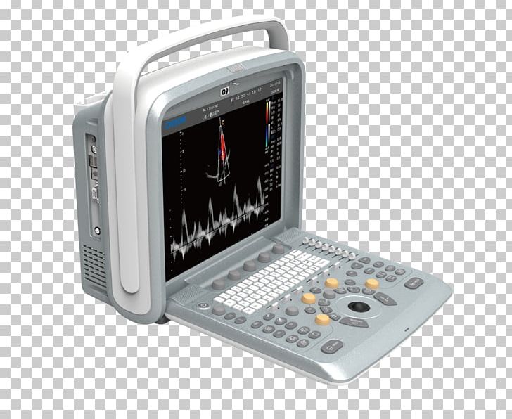 Ultrasound Ultrasonography Doppler Echocardiography Medical Imaging Medical Diagnosis PNG, Clipart, 3d Ultrasound, Clinic, Doppler Echocardiography, Electronic Instrument, Electronics Free PNG Download