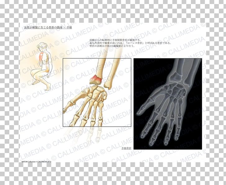 Thumb Product Design Hand Model Human PNG, Clipart, Arm, Art, Bone, Finger, Hand Free PNG Download