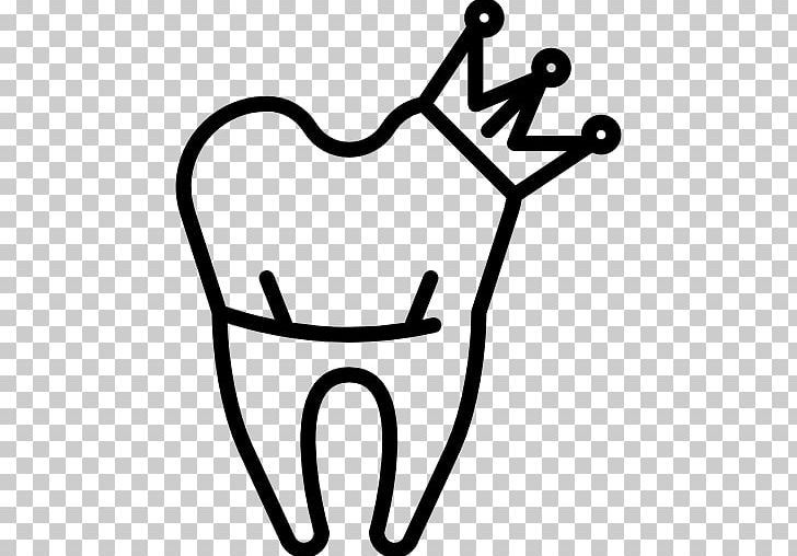 Crown Dentistry Computer Icons Human Tooth PNG, Clipart, Black And White, Crown, Dental Floss, Dental Instruments, Dental Restoration Free PNG Download