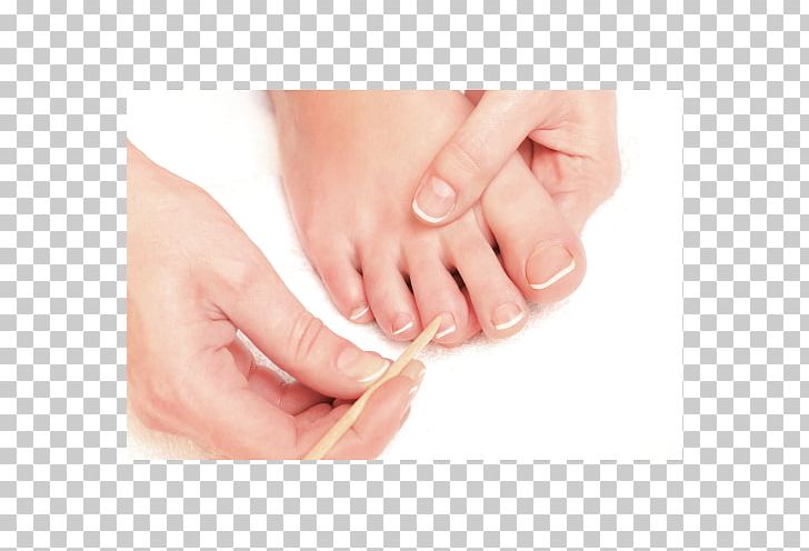 Pedicure Foot Nail Onychomycosis Beauty Parlour PNG, Clipart, Beauty, Beauty Parlour, Fench, Finger, Foot Free PNG Download