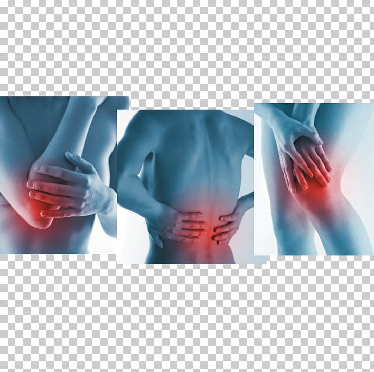 Arthritis Pain Zostrix-HP Back Pain Finger Plastic PNG, Clipart, Adhesive Bandage, Arm, Arthritis, Arthritis Pain, Back Pain Free PNG Download