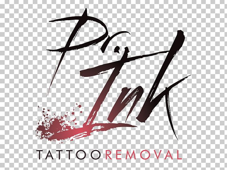 Ink Revoke Tattoo Removal Laser Skin PNG, Clipart, Angle, Black And White, Boulder, Boulder County Colorado, Branch Free PNG Download