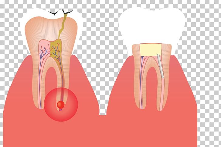 Shoulder Tooth Root Canal Gross Anatomy PNG, Clipart, Anatomy, Finger, Gross Anatomy, Hand, Head And Neck Anatomy Free PNG Download