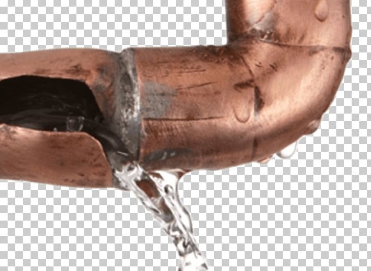 Leak Detection Plumbing Water Pipe PNG, Clipart, Arm, Building, Burst, Damage, Drain Free PNG Download