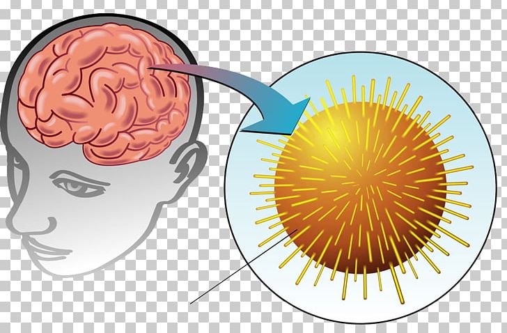 Inflammation Encephalitis Brain Infection Virus PNG, Clipart, Brains, Brain Thinking, Brain Vector, Cartoon Brain, Creative Brain Free PNG Download
