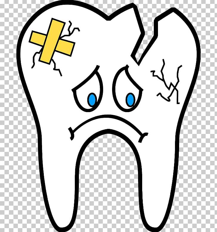 Human Tooth Dentistry Wisdom Tooth Dental Extraction PNG, Clipart, Area, Black And White, Dentin Hypersensitivity, Dentist, Dentures Free PNG Download