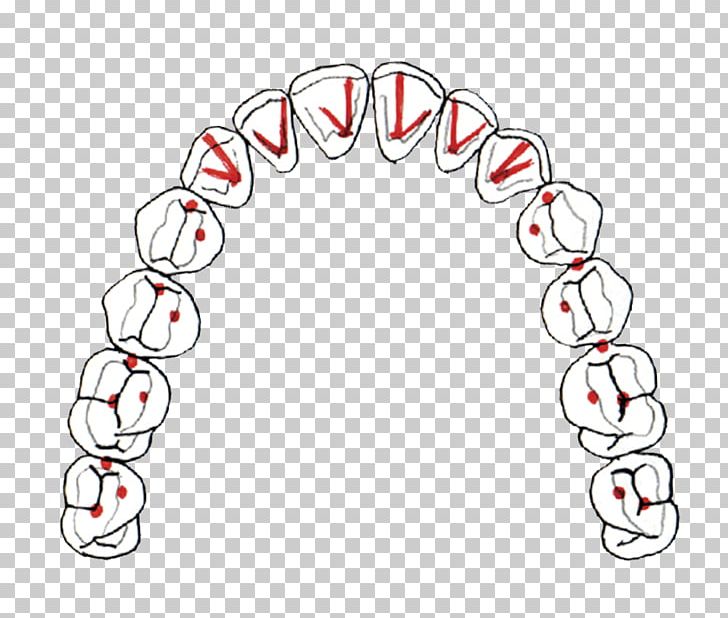Occlusion Dentistry Dental Midline Centric Relation Dental Braces PNG, Clipart, Angle, Area, Auto Part, Body Jewelry, Canine Tooth Free PNG Download