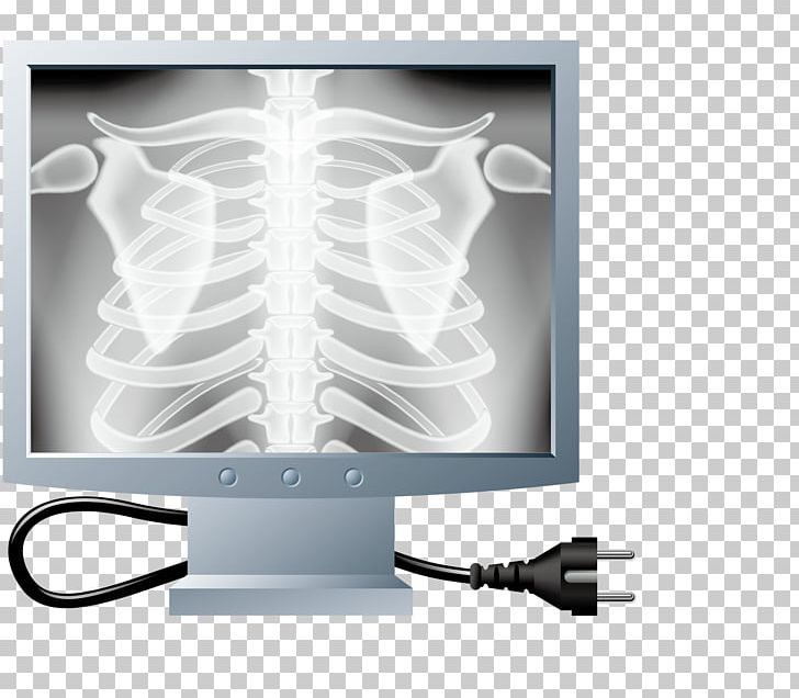 X-ray Rib Bone Cartoon PNG, Clipart, Angle, Art, Bones, Bones Vector, Check Free PNG Download