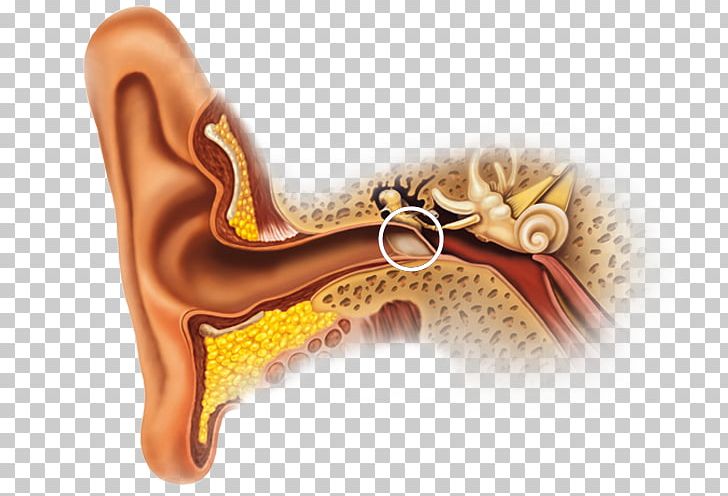 Earwax Inner Ear Ear Canal Outer Ear PNG, Clipart, Anatomy, Auditory Event, Ear, Ear Canal, Eardrum Free PNG Download
