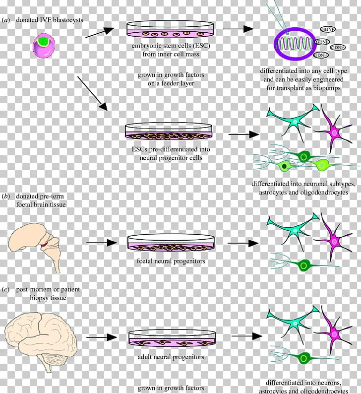 Neurodegeneration Stem Cell Stem-cell Therapy Brain PNG, Clipart, Angle, Area, Brain, Cell, Cell Therapy Free PNG Download