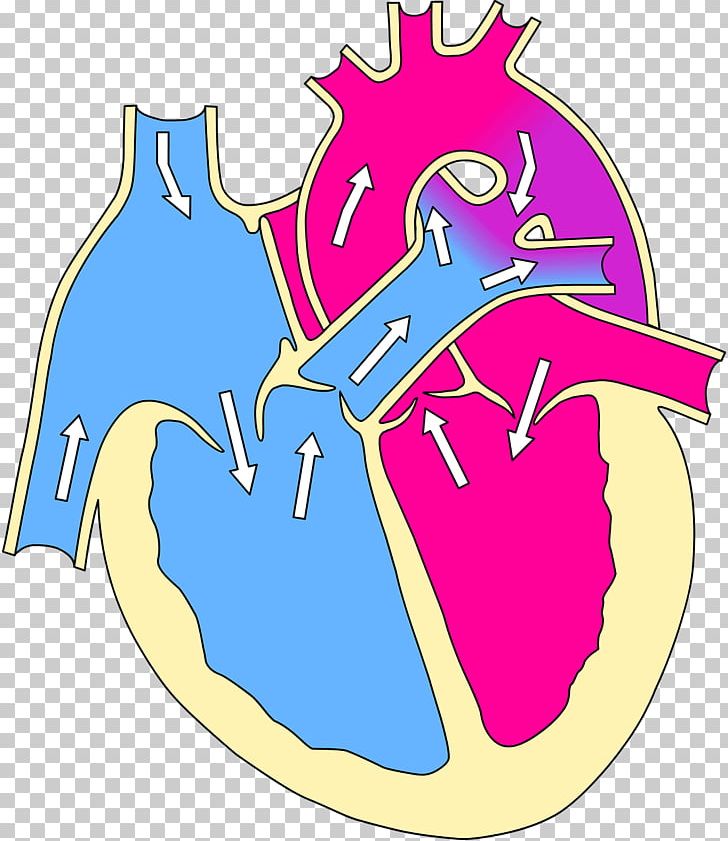 Tetralogy Of Fallot Ventricular Septal Defect Congenital Heart Defect Patent Ductus Arteriosus PNG, Clipart, Area, Artwork, Atrial Septal Defect, Birth Defect, Cardiac Surgery Free PNG Download