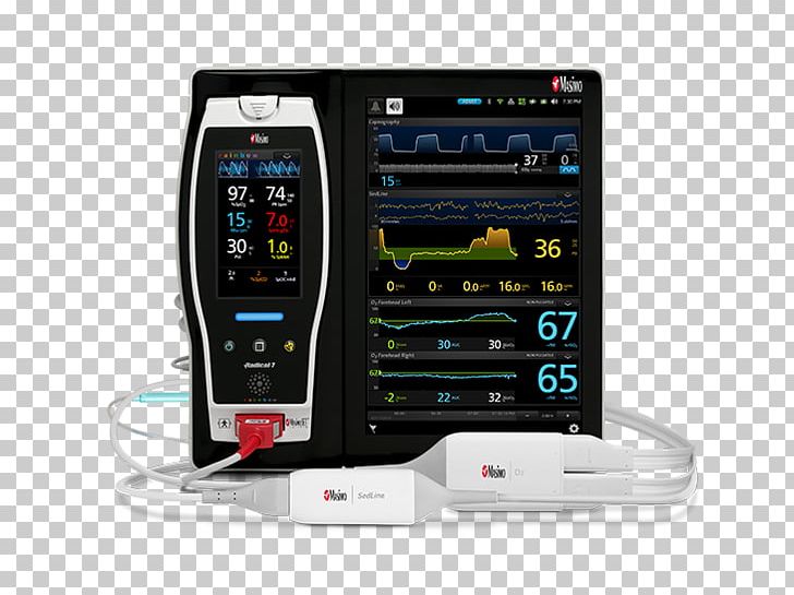 Masimo Monitoring Brain CO-oximeter Pulse Oximetry PNG, Clipart, Anesthesia, Brain, Communication, Continuous Monitoring, Cooximeter Free PNG Download