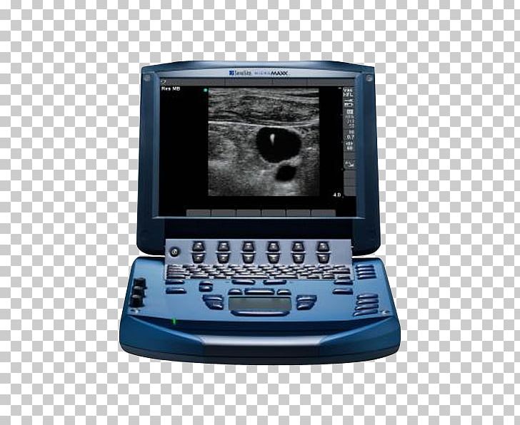 Acuson Ultrasonography Portable Ultrasound SonoSite PNG, Clipart, Acuson, Display Device, Electronic Device, Electronics, Gadget Free PNG Download