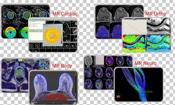 Nuclear Medicine Canon Medical Systems Corporation Magnetic Resonance Imaging PNG, Clipart, Associate Professor, Brand, Canon, Canon Medical Systems Corporation, Corporation Free PNG Download