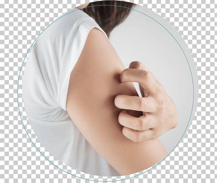 Itch La Peau Dermatology: Zaina Rashid PNG, Clipart, Arm, Chin, Cream, Cutaneous Condition, Dermatitis Free PNG Download