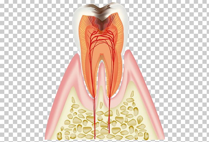 歯科 Dentist Tooth Decay Periodontal Disease PNG, Clipart, Dental Caries, Dentist, Dentures, Disease, Ear Free PNG Download
