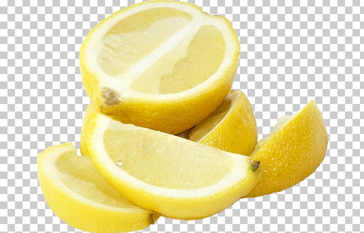 Lemon Food Health Pregnancy Gallbladder Flush PNG, Clipart, Citric Acid, Citron, Citrus, Detoxification, Food Free PNG Download