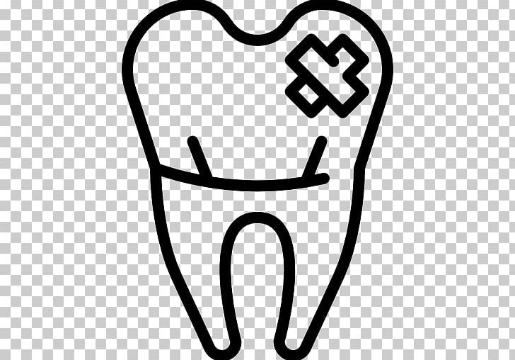 Dentistry Dental Implant Human Tooth PNG, Clipart, Area, Black And White, Bone Fracture, Bridge, Cracked Tooth Syndrome Free PNG Download