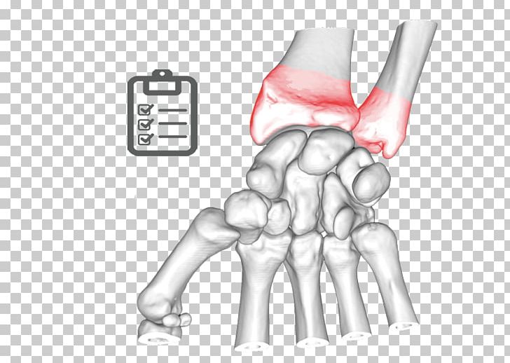 Thumb Elbow Bone Ulnar Nerve Joint PNG, Clipart, Abdomen, Anatomical Terms Of Location, Arm, Bone, Carpal Bones Free PNG Download