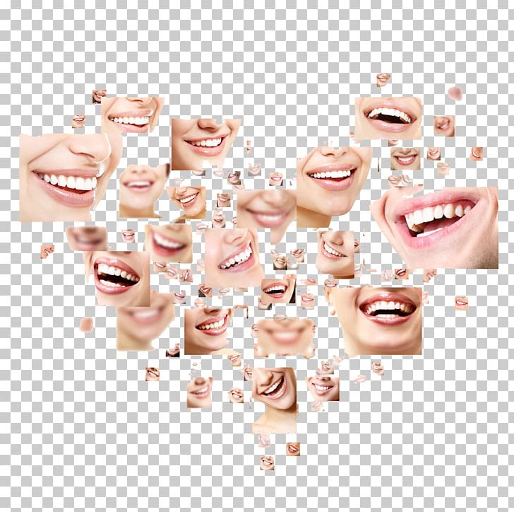 Smile Stock Photography Dentistry Human Tooth Shutterstock PNG, Clipart, Cheek, Collage, Cosmetic Dentistry, Dentist, Dentistry Free PNG Download