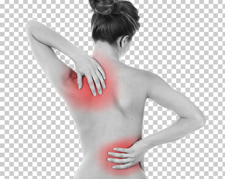 Back Pain Human Back Neck Pain Disease Scoliosis PNG, Clipart, Abdomen, Ache, Acute Disease, Arm, Back Free PNG Download