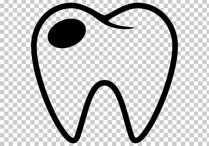 Tooth Decay Dentistry Human Tooth PNG, Clipart, Black, Black And White, Circle, Computer Icons, Dental Composite Free PNG Download