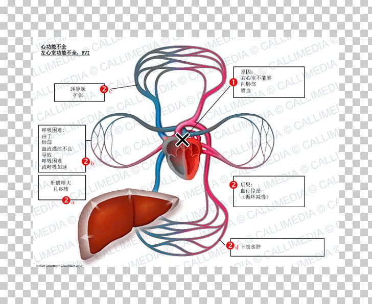 Heart Ailment Ventricle Cardiology Heart Rate Symptom PNG, Clipart, Angle, Aortic Insufficiency, Area, Blood, Cardiology Free PNG Download