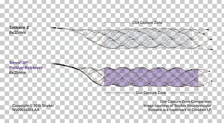 Stryker Corporation Stenting Catheter Patience Thrombus PNG, Clipart, Angle, Catheter, Data, Diagram, Dioptre Free PNG Download