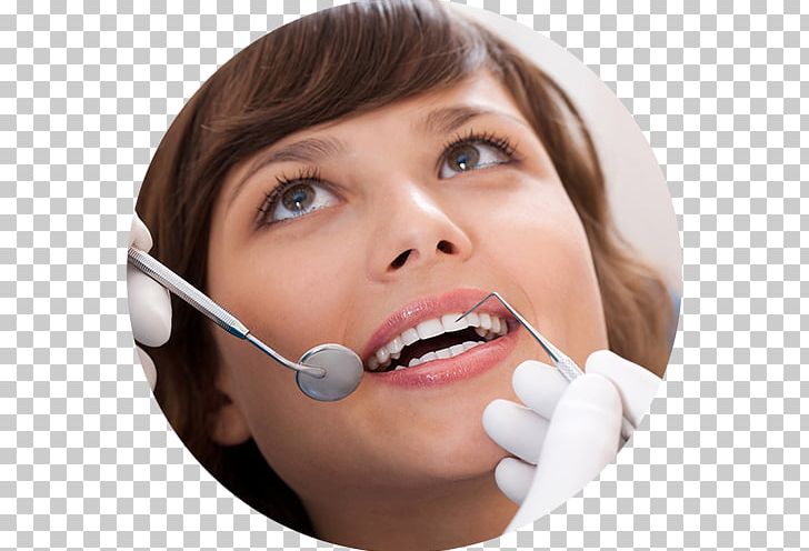 Dentistry Orthodontics Therapy Feya PNG, Clipart, Chin, Cosmetic Dentistry, Dental Implant, Dental Tourism, Dentistry Free PNG Download