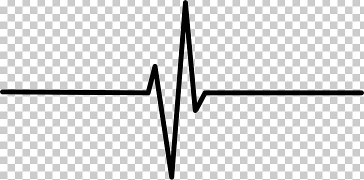 Pulse Electrocardiography Heart Rate PNG, Clipart, Angle, Atrial Fibrillation, Black And White, Cardiology, Clip Art Free PNG Download