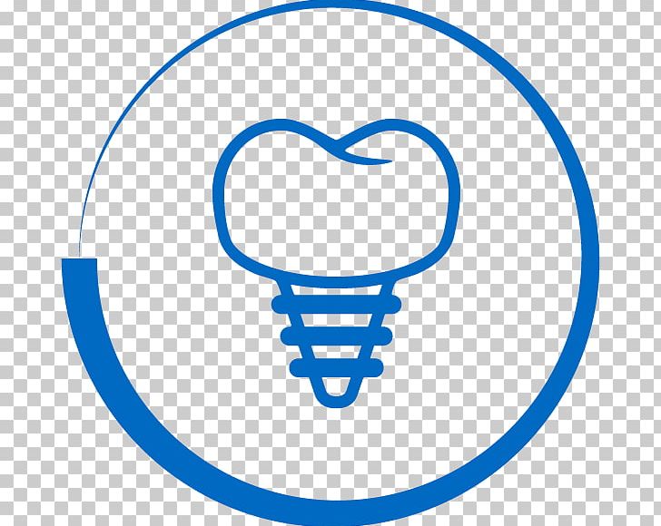Dental Implant Cosmetic Dentistry Dental Surgery PNG, Clipart, Area, Bridge, Circle, Cosmetic Dentistry, Crown Free PNG Download