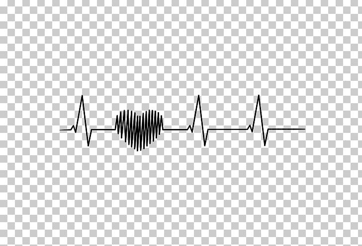Myocardial Infarction Heart Rate Electrocardiography Blood PNG, Clipart, Angle, Black, Black And White, Blood, Clef Free PNG Download