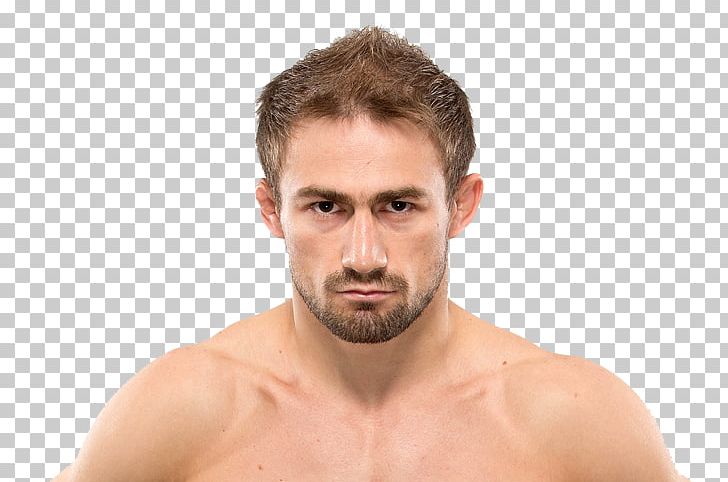 Conor McGregor Rubella Child UFC 202: Diaz Vs. McGregor 2 Virus PNG, Clipart, Arm, Barechestedness, Beard, Brian Ortega, Chest Free PNG Download