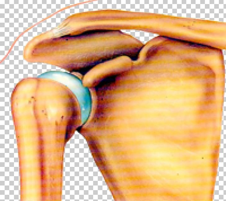 Joint Dislocation Shoulder Bone Arm PNG, Clipart, Arm, Bone, Cancer, Clavicle, Cone Free PNG Download