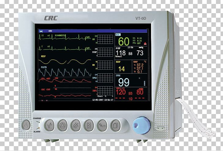 Monitoring Vital Signs Computer Monitors Display Device Pulse Oximetry PNG, Clipart, Computer Monitors, D Ace, Electronic Device, Electronics, Hospital Free PNG Download