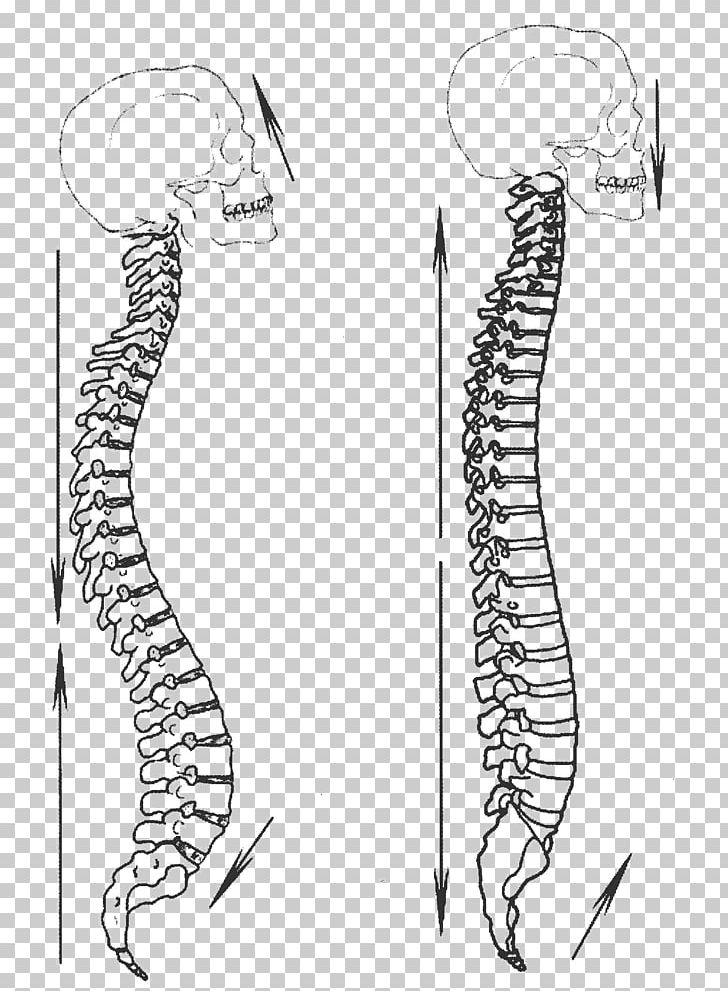 Yiquan Zhan Zhuang Martial Arts Xing Yi Quan Vertebral Column PNG, Clipart, Arm, Black And White, Bone, Drawing, Hand Free PNG Download