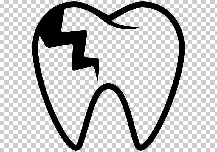 Tooth Decay Dentistry Human Tooth PNG, Clipart, Area, Black, Black And White, Bridge, Computer Icons Free PNG Download