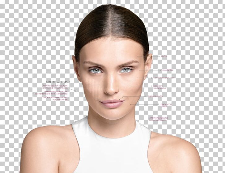 Collagen Induction Therapy Cosmetics Beauty Parlour Skin Microdermabrasion PNG, Clipart, Acne, Aesthetics, Beauty, Beauty Parlour, Black Hair Free PNG Download