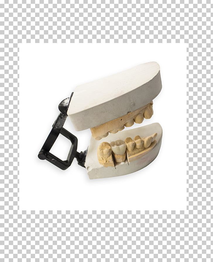 Digital Dentistry Dental Porcelain Ceramic Dental Laboratory PNG, Clipart, Ceramic, Dental Implant, Dental Laboratory, Dental Porcelain, Dental Restoration Free PNG Download