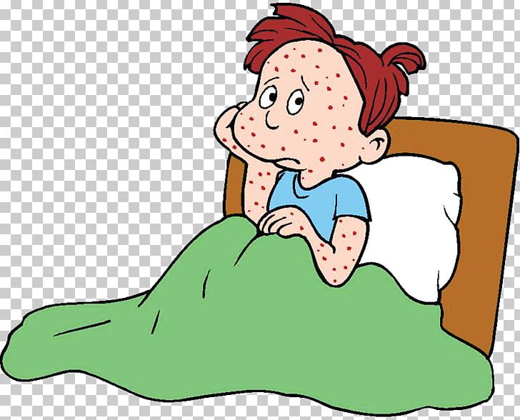 Chickenpox Infection Infectious Disease PNG, Clipart, Artwork, Chickenpox, Child, Disease, Facial Expression Free PNG Download