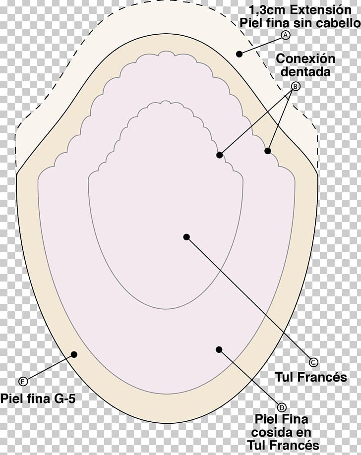 Prótesis Capilar Circle Angle Diagram Area PNG, Clipart, Angle, Animal, Area, Cartoon, Catalog Free PNG Download