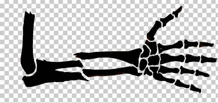 Bone Fracture Arm Drawing Clavicle PNG, Clipart, Arm, Black And White, Bone, Bone Fracture, Bone Healing Free PNG Download